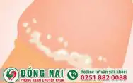 da khoa hong phuc