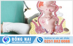 Bệnh hậu môn gồm những bệnh gì?