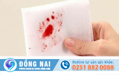 Nguyên nhân và cách chữa đi ngoài ra máu