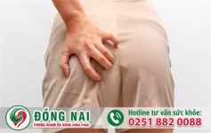 Chảy mủ hậu môn là bệnh gì và cách điều trị hiệu quả?