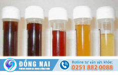 Đái buốt ra máu