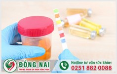 Dấu hiệu tiểu buốt có máu hoặc có mủ ở nữ giới