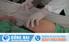 Hậu môn chảy mủ là bị bệnh gì?