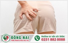 Hậu môn tiết dịch nhầy là bệnh gì?