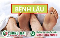 Làm sao nhận biết đó là dấu hiệu bệnh lậu mủ và cách hỗ trợ điều trị