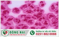 Nguyên nhân bệnh lậu ở nữ giới