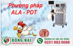 Phương pháp ALA - PDT hiện đại nhất trong chữa trị sùi mào gà