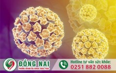 Sùi mào gà là bệnh gì?