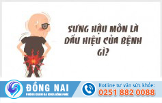 Sưng hậu môn là dấu hiệu của bệnh gì?