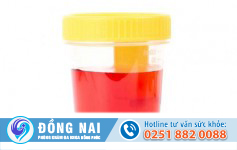Hiện tượng tiểu ra máu sau khi quan hệ