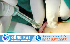 Đốt sùi mào gà có đau không?