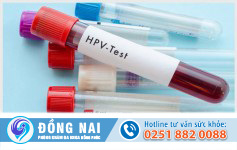 Xét nghiệm HPV âm tính là bị sùi mào gà hay không?