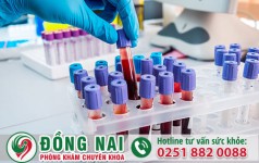 Xét nghiệm HPV ở đâu an toàn, nhanh chóng, chính xác