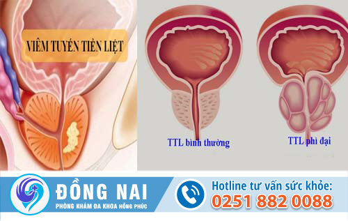 Bạn biết gì về các bệnh tuyến tiền liệt?