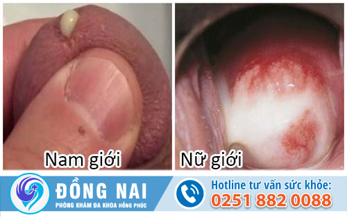 bệnh ở bộ phận sinh dục