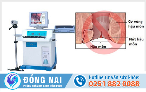 Cách chữa nứt kẽ hậu môn hiệu quả