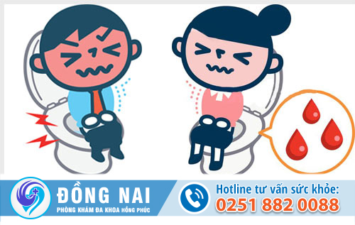 Có nên cắt trĩ hay không?