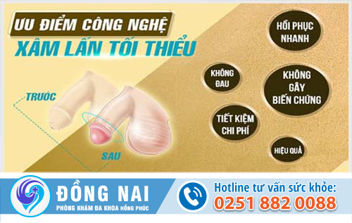 Dài bao quy đầu phải chữa trị làm sao?