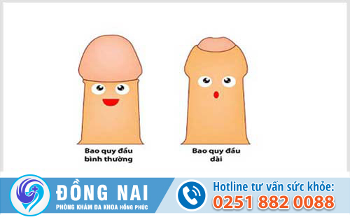 Giải thích hiện tượng dài bao quy đầu và phương pháp điều trị
