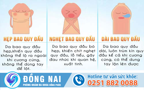 Khám nam khoa là khám những bệnh gì