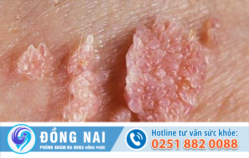 Mụn nhọt ở tinh hoàn