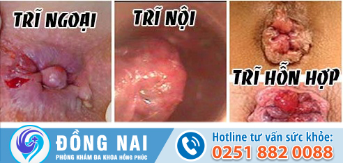 Nguyên nhân đi cầu ra máu