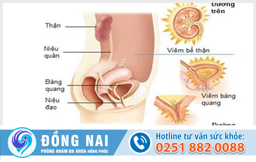 Bệnh lý đường tiết niệu
