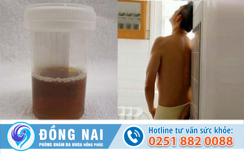 Những dấu hiệu nào cho thấy nam giới đang bị viêm bàng quang?