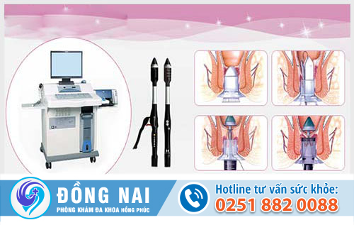 Sa búi trĩ điều trị bằng phương pháp ngoại khoa