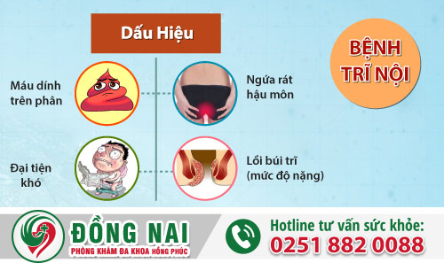 Dấu hiện trĩ nội điển hình