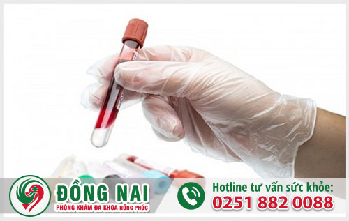Tiểu ra máu có nguy hiểm không - Điều trị ở đâu tốt tại Biên Hòa?