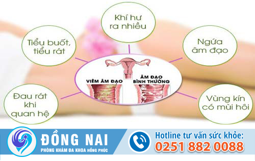 Triệu chứng cho thấy nữ giới đang bị nấm vùng kín và cách điều trị hiệu quả