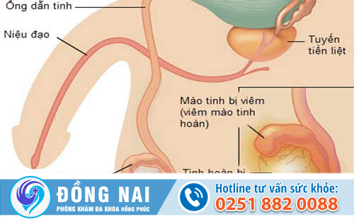 đi tiểu nhiều lần ở nam giới