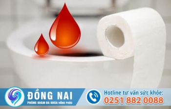 4 Dấu hiệu điển hình giúp bạn nhận biết bệnh nứt kẽ hậu môn