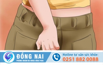 5 Mối nguy hại nguy hiểm chính của bệnh mụn hậu môn