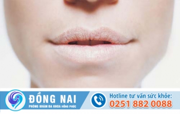 Quan hệ bằng miệng có lây bệnh lậu không?