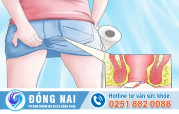 Ngứa hậu môn thường xuyên có nguy hiểm không?