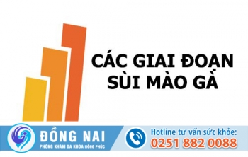 Các giai đoạn sùi mào gà