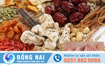 Chữa trị sùi mào gà bằng đông y