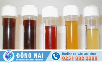 Đái buốt ra máu