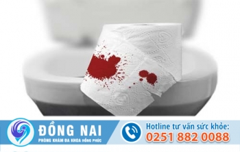 Đại tiện ra máu là do đâu? Có nguy hiểm không?