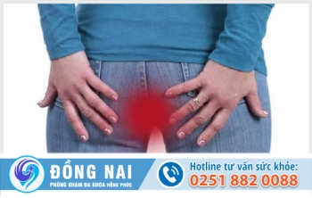 Đau hậu môn là bệnh gì?