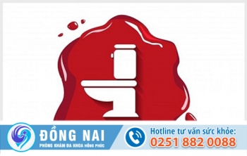 Đi cầu ra máu nhưng không đau là dấu hiệu bệnh gì?