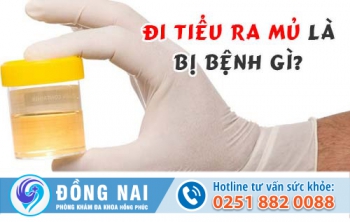 Đi tiểu ra mủ là bị bệnh gì?