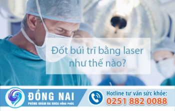 Đốt búi trĩ bằng laser như thế nào?