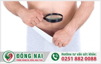 Hẹp bao quy đầu để lâu có nguy hiểm không và cách điều trị ra sao?