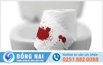 Hiện tượng đi cầu ra máu là triệu chứng dấu hiệu của bệnh gì? Có gây nguy hiểm gì đến sức khỏe không?
