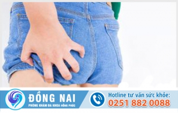 Một số căn bệnh dẫn đến tình trạng đau ngứa hậu môn