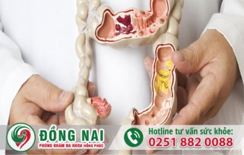 Một số câu hỏi thường gặp về bệnh trĩ - hậu môn