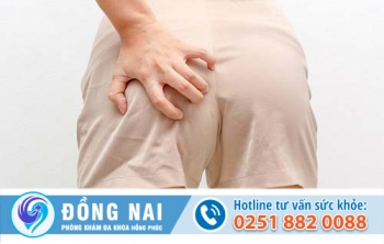 Ngứa hậu môn – Nguyên nhân và cách điều trị hiệu quả